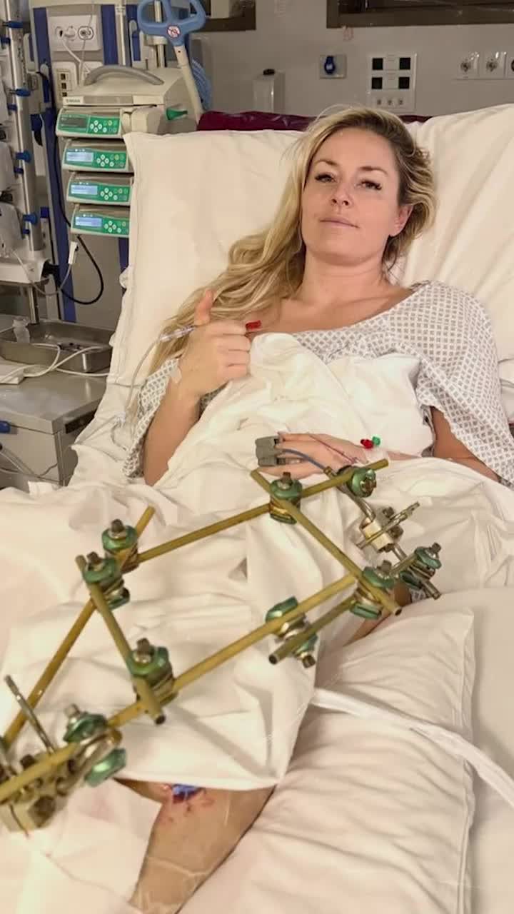  Riscă să răm&acirc;nă cu sechele pe viață Verdictul unui&nbsp;specialist după  accidentarea gravă suferită de Lindsey Vonn la JO 2026: &bdquo;Leziunile pot duce la amputare&rdquo;