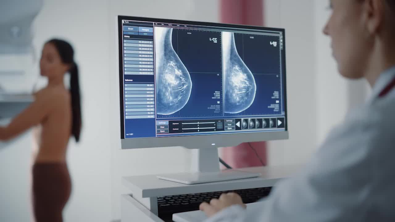 Mamografie 3D cu tomosinteză