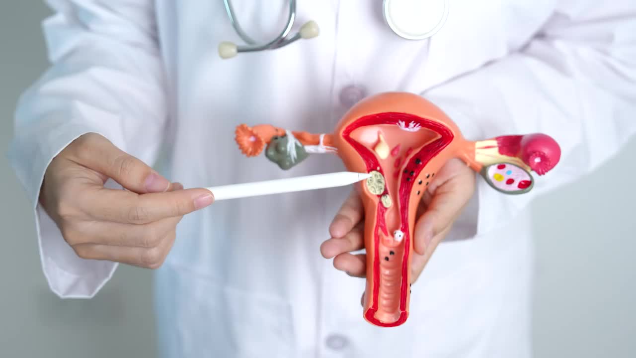 Cancer de col uterin